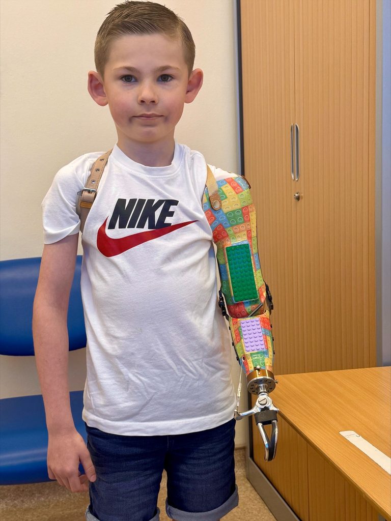 LEGO Portsmouth hospitals university NHS trust LEGO prosthetic 2 768x1024